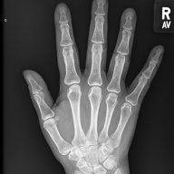 Bones